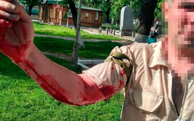 Поножовщина в Запорожье: Мужчины не поделили девушку Фото № 1 Поножовщина в Запорожье: Мужчины не поделили девушку Фото № 1