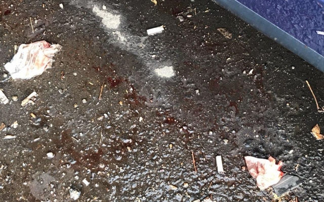 ДТП на Победе: Легковушка влетела в бетонную опору моста (ФОТО) Фото № 2 ДТП на Победе: Легковушка влетела в бетонную опору моста (ФОТО) Фото № 2