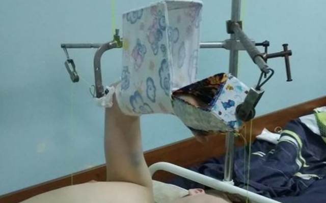 Стало известно о состоянии сбитого в Запорожье 17-летнего парня (ФОТО) Фото № 0 Стало известно о состоянии сбитого в Запорожье 17-летнего парня (ФОТО) Фото № 0