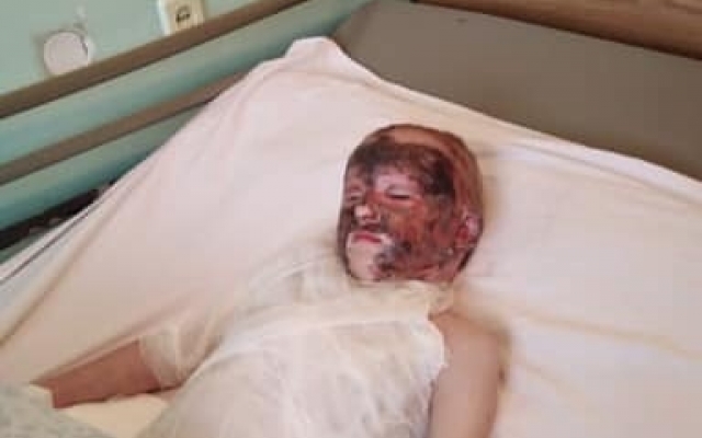 В Запорожье просят помочь маленькой девочке, которая получила серьезные ожоги (ФОТО) Фото № 0 В Запорожье просят помочь маленькой девочке, которая получила серьезные ожоги (ФОТО) Фото № 0