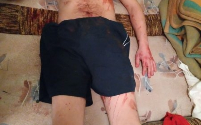 В Коммунарском районе женщина вонзила нож в грудь сожителю (ФОТО 18+) Фото № 1 В Коммунарском районе женщина вонзила нож в грудь сожителю (ФОТО 18+) Фото № 1