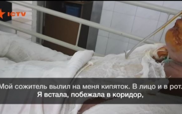 Лил кипяток прямо в рот: Девушка, которую облил кипящей водой сожитель, дала интервью (ФОТО) Фото № 0 Лил кипяток прямо в рот: Девушка, которую облил кипящей водой сожитель, дала интервью (ФОТО) Фото № 0