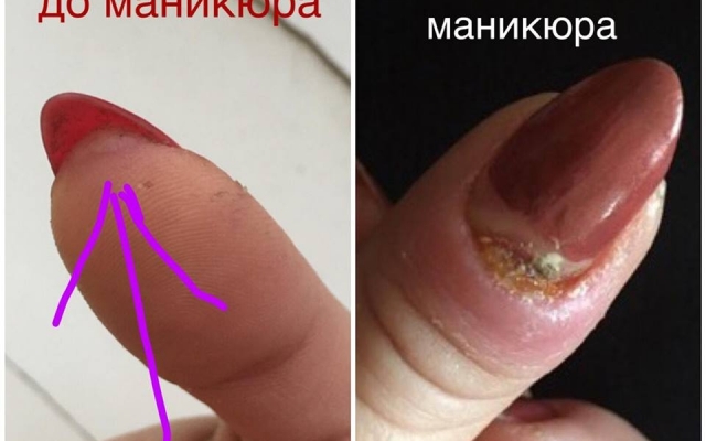 Известная запорожанка пострадала в салоне красоты (ФОТО) Фото № 2 Известная запорожанка пострадала в салоне красоты (ФОТО) Фото № 2