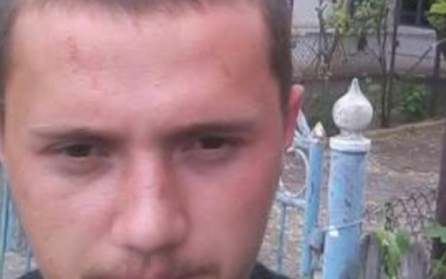 Стало известно о состоянии парня, подорвавшегося на мине Фото № 0 Стало известно о состоянии парня, подорвавшегося на мине Фото № 0