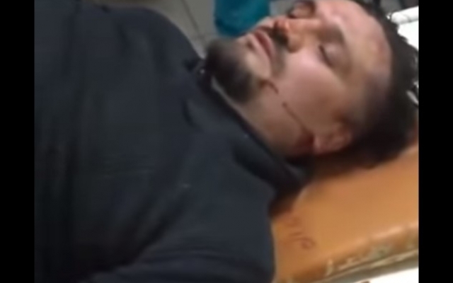 В Запорожье с битами и молотком напали на активиста (ВИДЕО) Фото № 1 В Запорожье с битами и молотком напали на активиста (ВИДЕО) Фото № 1