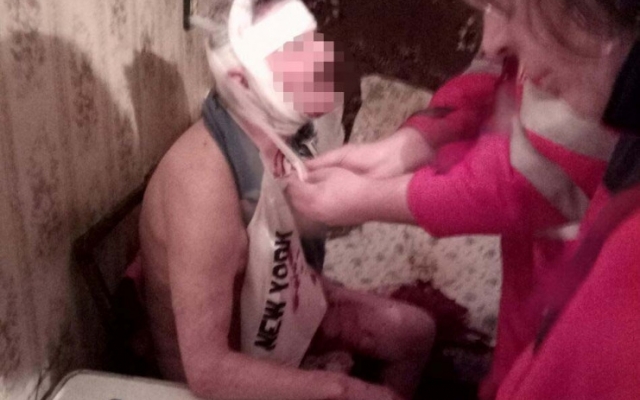 В Запорожье пенсионерка проломила голову своему мужу табуреткой (ФОТО 18+) Фото № 0 В Запорожье пенсионерка проломила голову своему мужу табуреткой (ФОТО 18+) Фото № 0