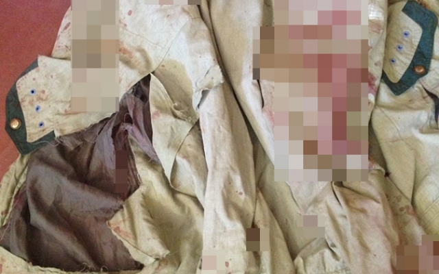 В лифте ограбили и жестоко избили мужчину (ФОТО) Фото № 1 В лифте ограбили и жестоко избили мужчину (ФОТО) Фото № 1