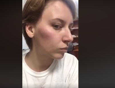 Во время акции около ГУ Нацполиции в Запорожье пострадала журналистка (ФОТО, ВИДЕО) Фото № 4 Во время акции около ГУ Нацполиции в Запорожье пострадала журналистка (ФОТО, ВИДЕО) Фото № 4