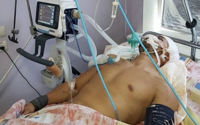 В Запорожье просят помощи парню, который находится в реанимации после ДТП (ФОТО) Фото № 0 В Запорожье просят помощи парню, который находится в реанимации после ДТП (ФОТО) Фото № 0