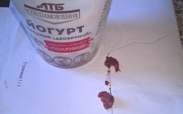 В запорожском супермаркете продают йогурт с волосами Фото № 1 В запорожском супермаркете продают йогурт с волосами Фото № 1