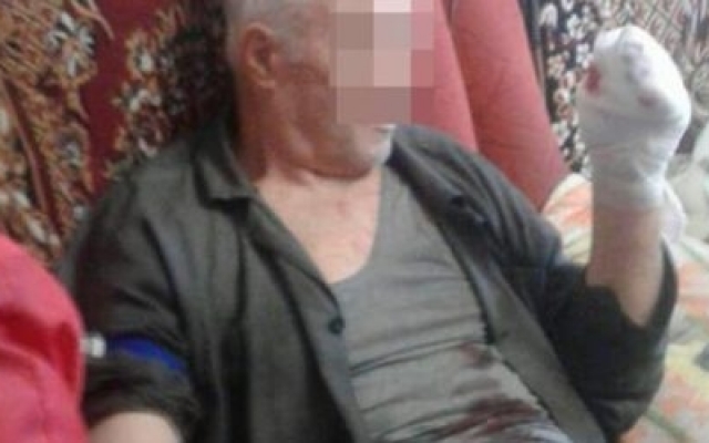 У запорожца прямо в руках разорвалась граната (ФОТО) Фото № 1 У запорожца прямо в руках разорвалась граната (ФОТО) Фото № 1