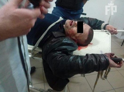 Смотрите: запорожцу проломили голову кирпичом Фото № 0 Смотрите: запорожцу проломили голову кирпичом Фото № 0