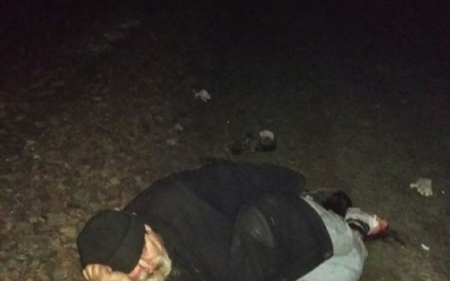 Травматическая ампутация: В Запорожье поезд наехал на человека. ФОТО 18+ Фото № 1 Травматическая ампутация: В Запорожье поезд наехал на человека. ФОТО 18+ Фото № 1