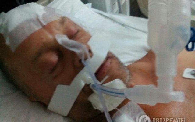 Гражданина России, который избил до полусмерти запорожца, отпустили за 800 долларов (ФОТО) Фото № 0 Гражданина России, который избил до полусмерти запорожца, отпустили за 800 долларов (ФОТО) Фото № 0