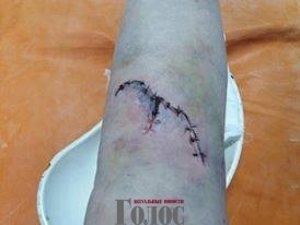 В Запорожской области медики травмировали инвалида. ФОТО 18+ Фото № 1 В Запорожской области медики травмировали инвалида. ФОТО 18+ Фото № 1