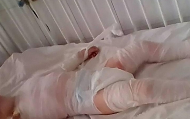 В Запорожье двое детей сварились в бульоне: В Запорожье двое детей сварились в бульоне: