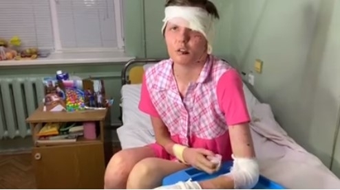 Настя Шаповалова, которую ошпарил сожитель, рассказала о своей жизни с тираном (ВИДЕО) Фото № 0 Настя Шаповалова, которую ошпарил сожитель, рассказала о своей жизни с тираном (ВИДЕО) Фото № 0