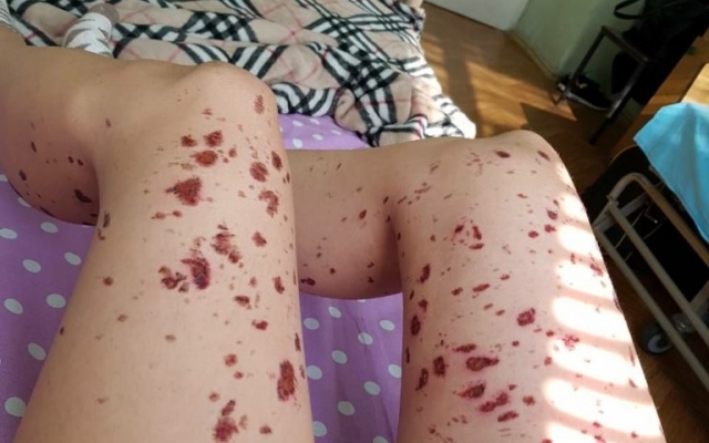 Жительница Запорожья, которая пострадала от рук бывшего парня, рассказала о своей жизни в страхе (ФОТО) Фото № 1 Жительница Запорожья, которая пострадала от рук бывшего парня, рассказала о своей жизни в страхе (ФОТО) Фото № 1