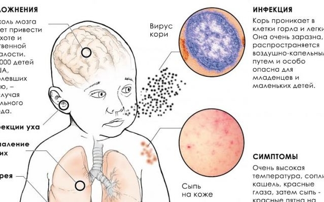 Болезнь с тяжелыми последствиями продолжает распространяться на Запорожье Фото № 0 Болезнь с тяжелыми последствиями продолжает распространяться на Запорожье Фото № 0