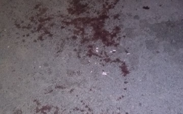 В Запорожье произошла поножовщина: Пострадавшие в больнице (ФОТО) Фото № 0 В Запорожье произошла поножовщина: Пострадавшие в больнице (ФОТО) Фото № 0