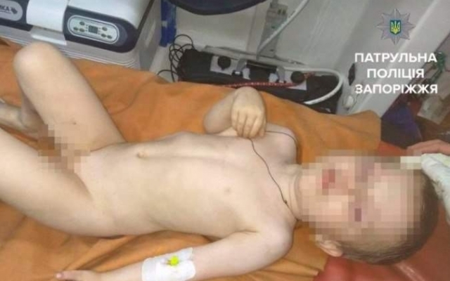Запорожцам показали мальчика, выпавшего из окна (ВИДЕО) Фото № 0 Запорожцам показали мальчика, выпавшего из окна (ВИДЕО) Фото № 0