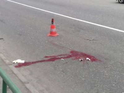 В Запорожье на Образцовой сбили ребенка: у девочки сотрясение мозга Фото № 0 В Запорожье на Образцовой сбили ребенка: у девочки сотрясение мозга Фото № 0