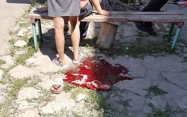 Под Запорожьем в ходе семейной разборки женщина выпала из окна (ФОТО 18+) Фото № 1 Под Запорожьем в ходе семейной разборки женщина выпала из окна (ФОТО 18+) Фото № 1