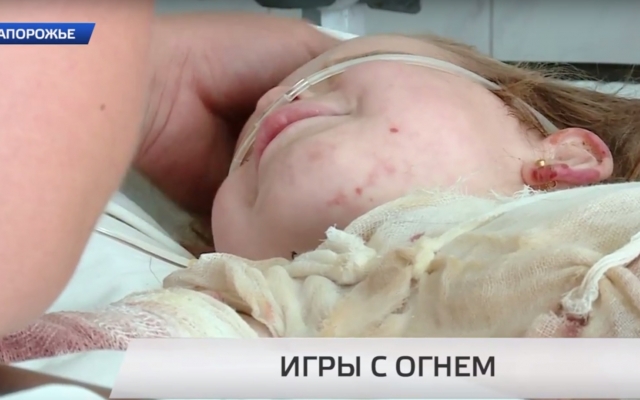 Запорожцам показали обгоревшую девочку: Ребенок нуждается в помощи (ВИДЕО) Фото № 0 Запорожцам показали обгоревшую девочку: Ребенок нуждается в помощи (ВИДЕО) Фото № 0