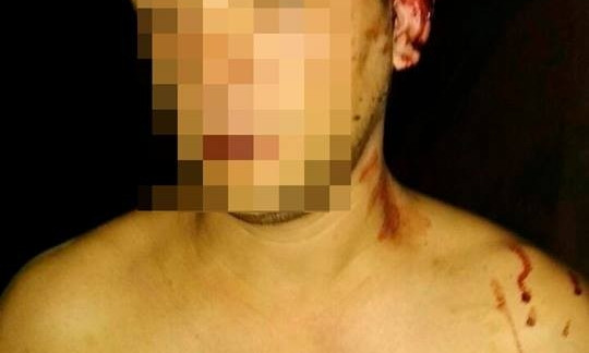 В Запорожье изрезали мужчину (ФОТО)
