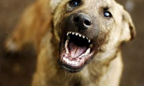 Очередное нападение на детей: Домашний пес искусал 12-летнего ребенка