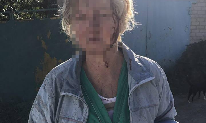 В Запорожье молодую женщину избил пожилой мужчина (ФОТО)