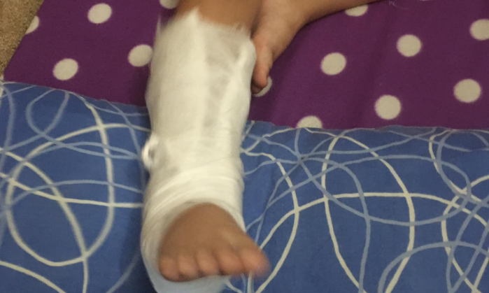 В Запорожской области ребенку, который сломал в саду ногу, даже не вызвали "скорую" (ФОТО)