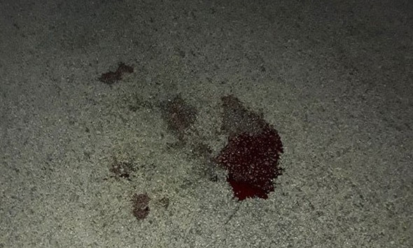 На Набережной магистрали обнаружили девушку, лежащую в крови (ФОТО)